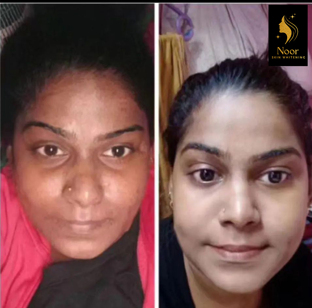 WhatsApp Image 2025-07-04 at 15.03.35_31b2e851