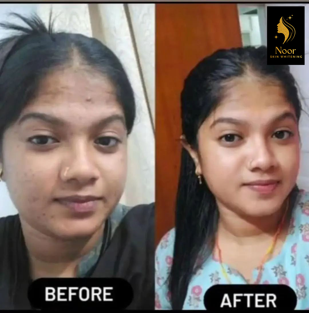 WhatsApp Image 2025-07-04 at 15.03.35_d6b24bba